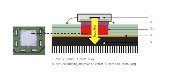 Metal Inlay Technology